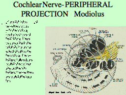 Cochlear Nerve- PERIPHERAL PROJECTION    Modiolus