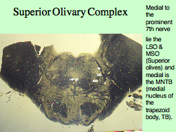 Superior Olivary Complex