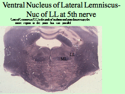 Ventral Nucleus of Lateral Lemniscus-  Nuc of LL at 5th nerve 