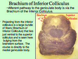 Brachium of Inferior Colliculus