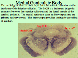 Medial Geniculate Body