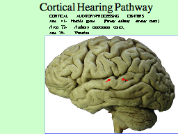 Cortical Hearing Pathway