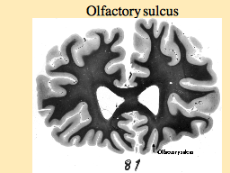 Olfactory sulcus