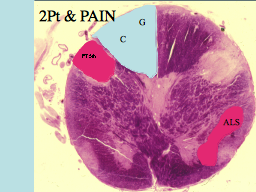 2Pt & PAIN