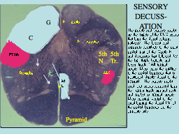 SENSORY DECUSS-ATION