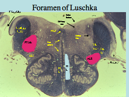 Foramen of Luschka