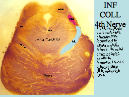 INF COLL 4th Nerve