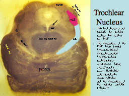 Trochlear Nucleus