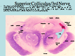 Superior Colliculus/3rd Nerve