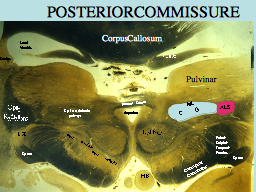 POSTERIOR COMMISSURE