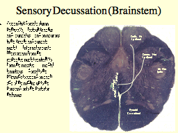 Sensory Decussation (Brainstem)