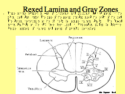 Rexed Lamina and Gray Zones