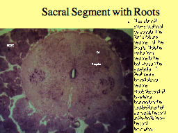 Sacral Segment with Roots