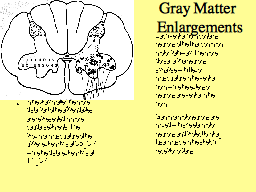 Gray Matter  Enlargements