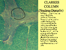   CLARKES COLUMN (Nucleus Dorsalis)