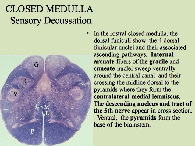 CLOSED MEDULLA Sensory Decussation