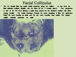 Facial Colliculus