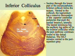 Inferior Colliculus