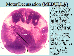 Motor Decussation  (MEDULLA)