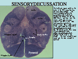 SENSORY DECUSSATION