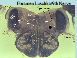 Foramen Luschka/9th Nerve