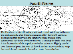 Fourth Nerve