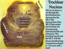 Trochlear Nucleus