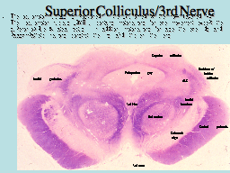 Superior Colliculus/3rd Nerve