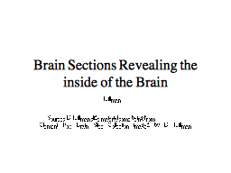 Brain Sections Revealing the inside of the Brain