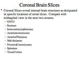 Coronal Brain Slices