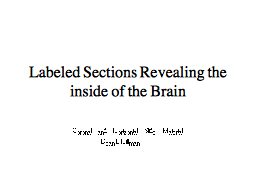 Brain Sections Revealing the inside of the Brain
