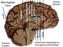 Mid-Sagittal       View